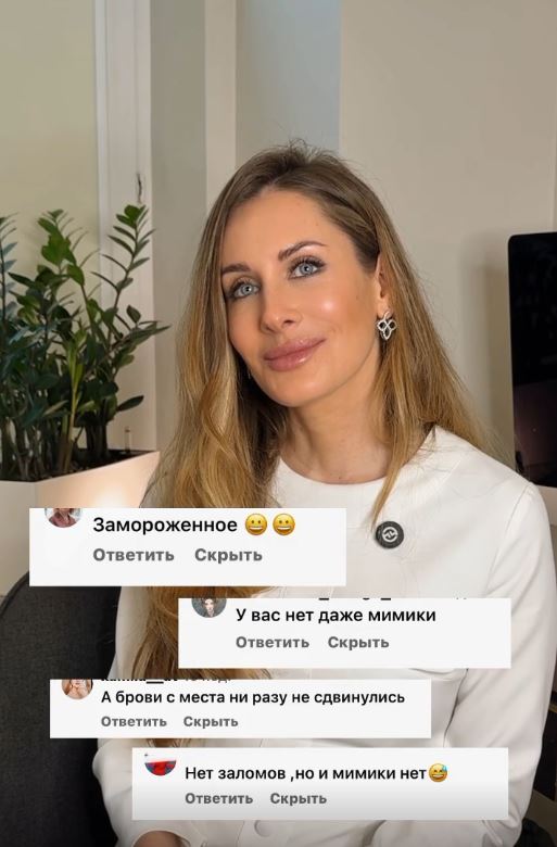Естественная мимика после ботулинотерапии