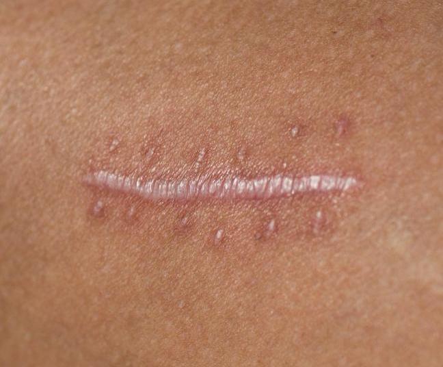 противопоказания