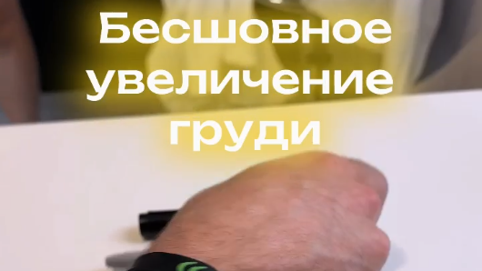 Бесшовное увеличение груди - это уникальная методика, которая позволяет получить красивую грудь без шва, синяков и следов от дренажей, возможностью сохранить лактацию!