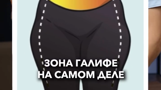 Зона «галифе» – одна из наиболее проблемных областей. 