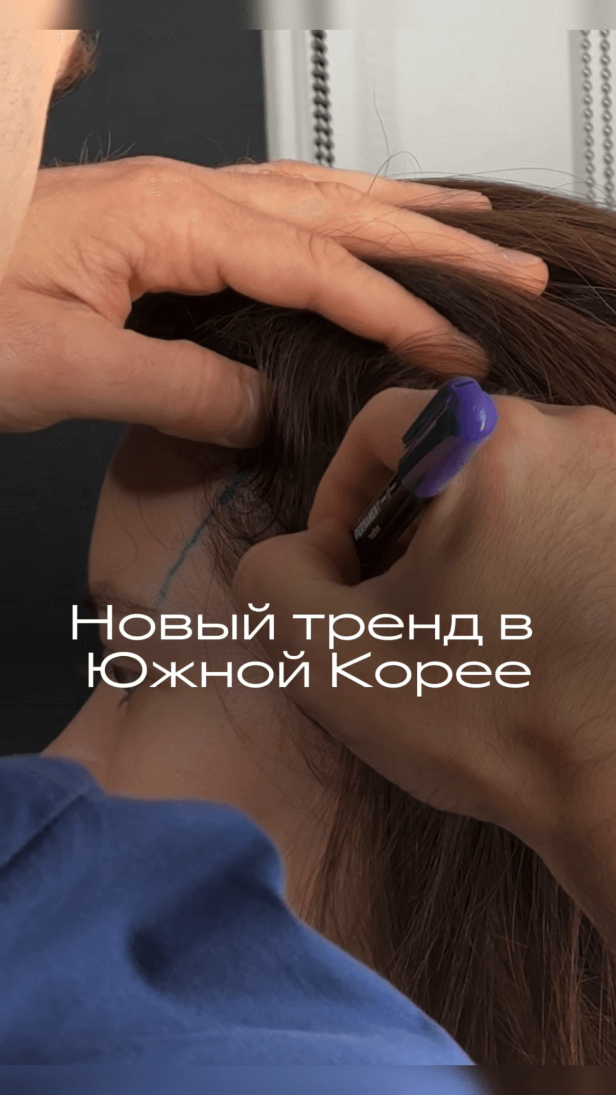 Зачем они нужны? Филлеры в область нижнего века.