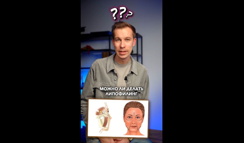 Макс - Липфилинг в лицо_14262