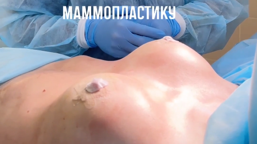 Установил пациентке 215-ый имплантат анатомической формы.