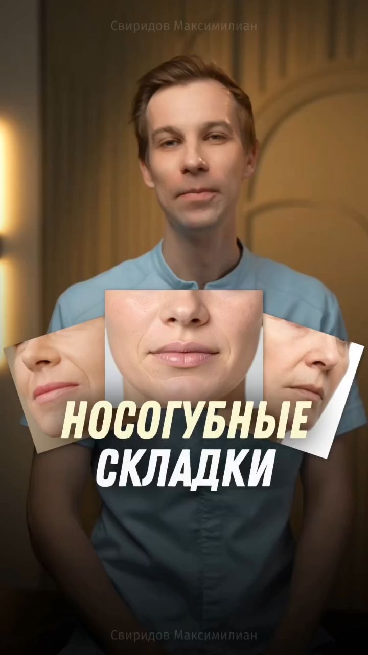 Носогубная складка — как она появляется и можно ли ее убрать хирургически? 