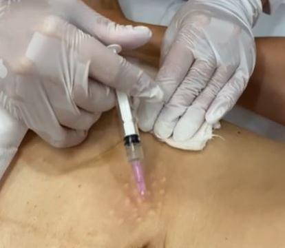 Отзыв о коллагене Collost Micro