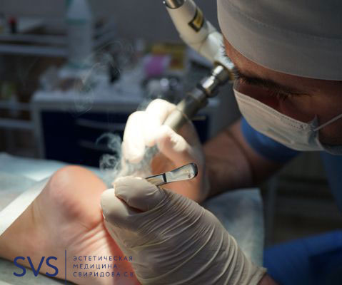 Лазерная хирургия