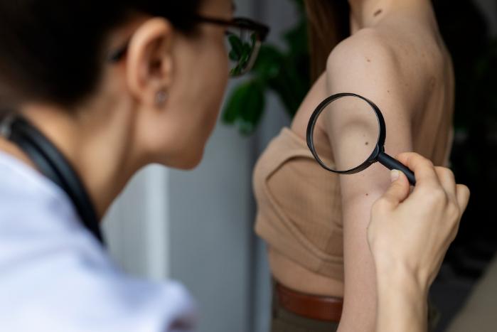 Лазерное удаление папиллом