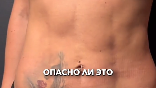 ВВ Липо