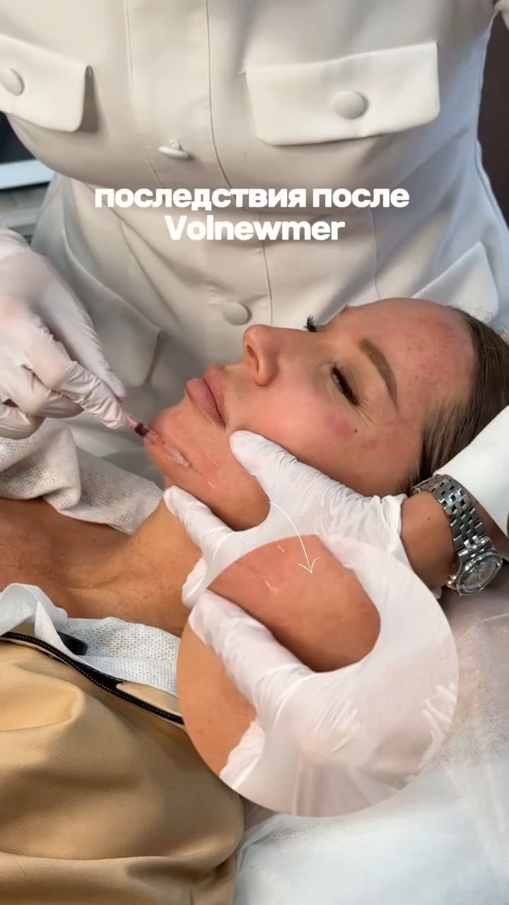 Последствия после Volnewmer