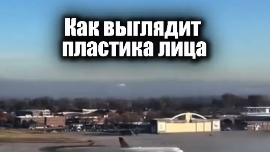 Какие вас останавливают страхи выполнить пластику лица?