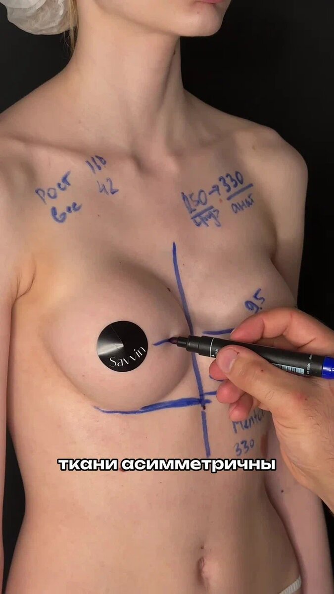 Ни один хирург не любит этот пипец!