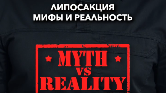 Липосакция мифы и реальность