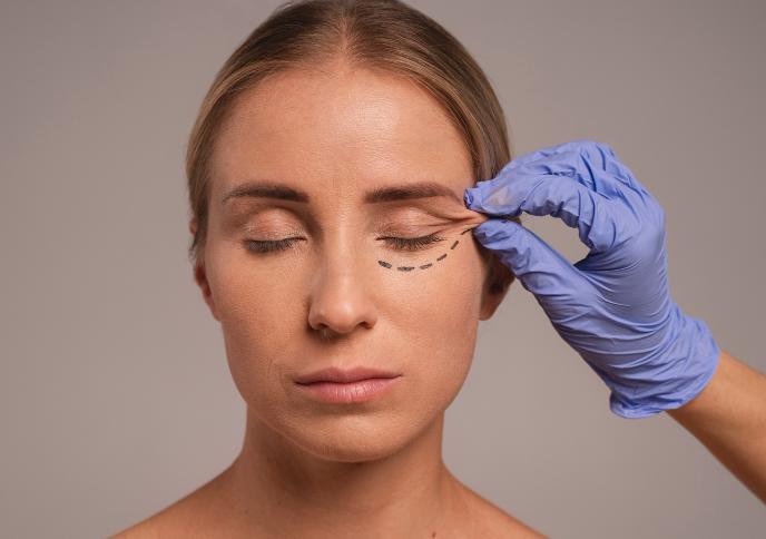 Бесшовная блефаропластика нижних век