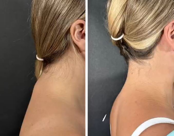 Холка — это зона, с которой можно и нужно работать.