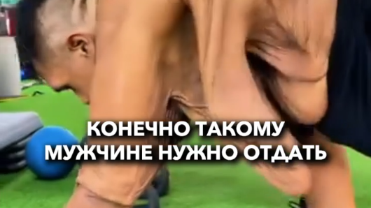Провисшая кожа после похудения