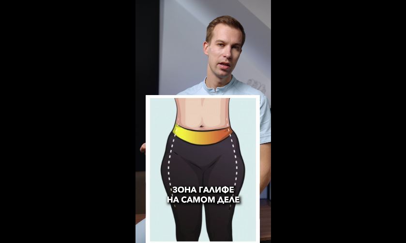 Зона Галифе