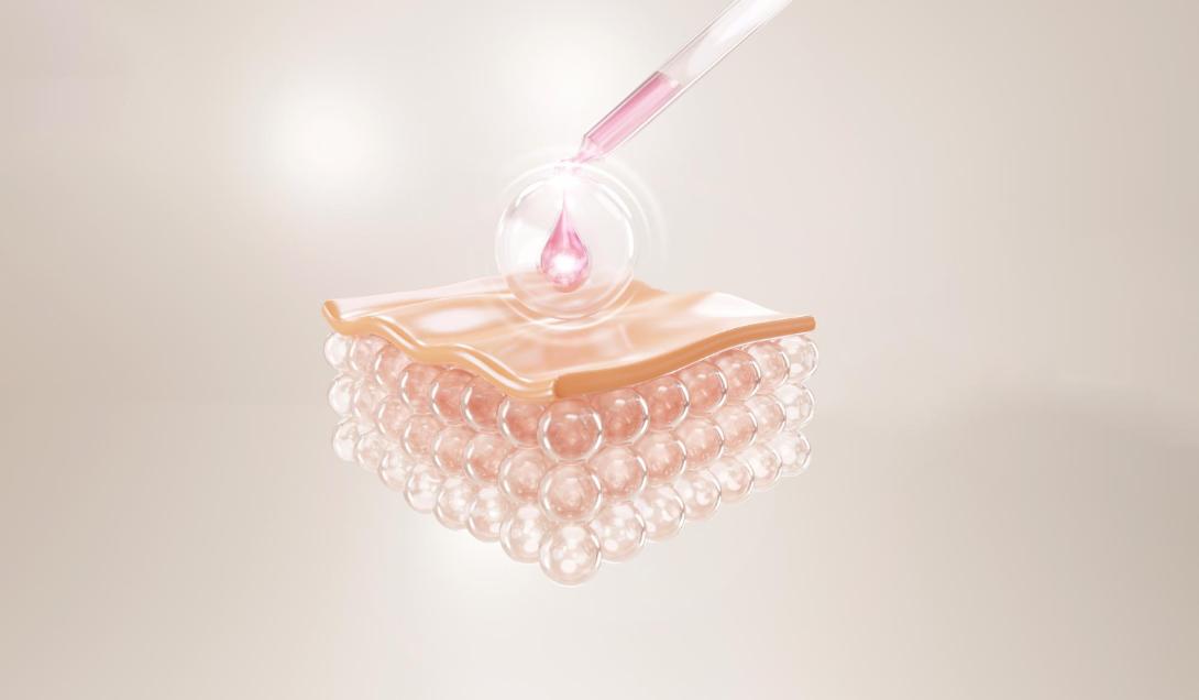 СПРС-терапия