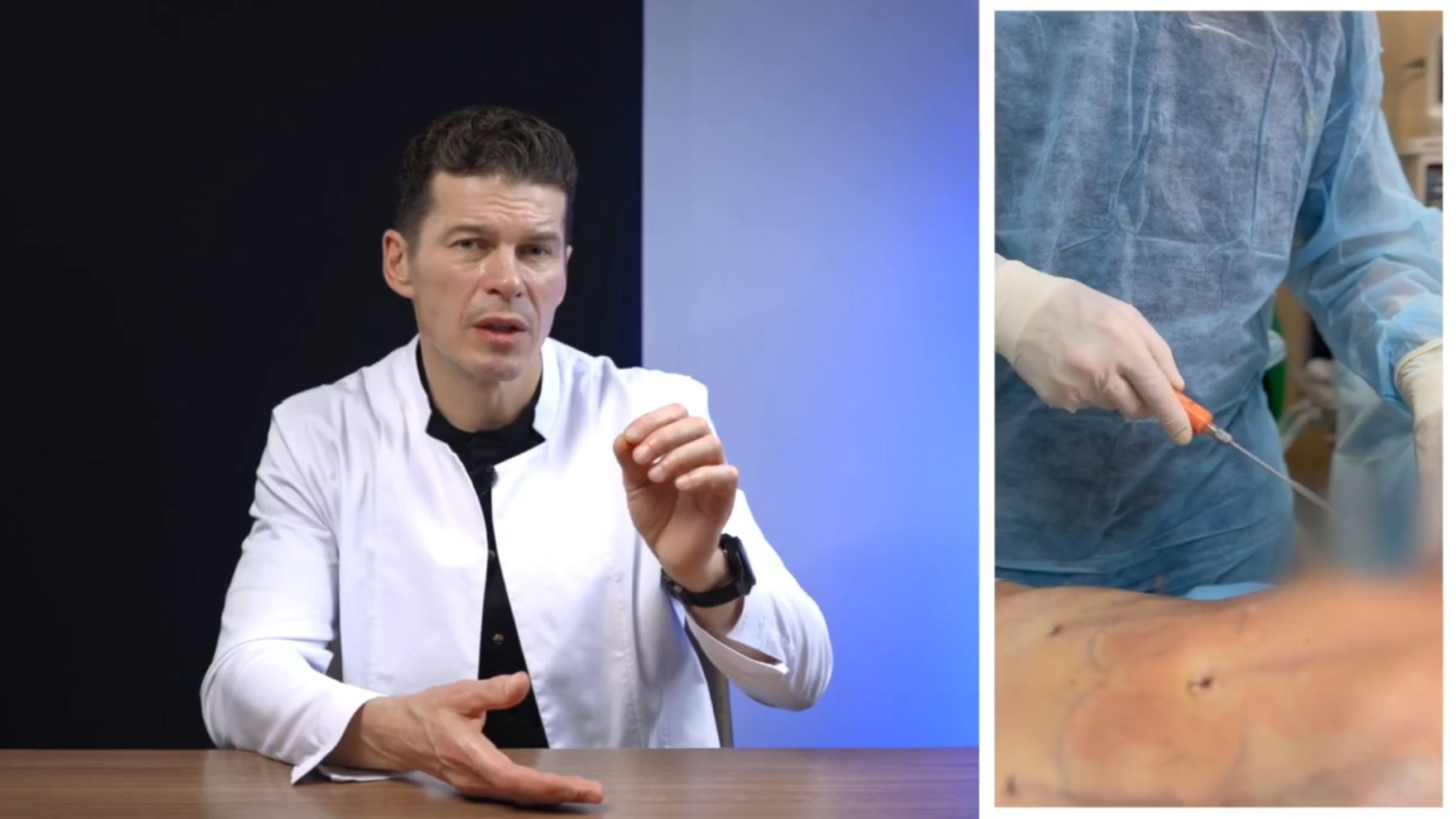 Сергей Свиридов - липофилинг_14247