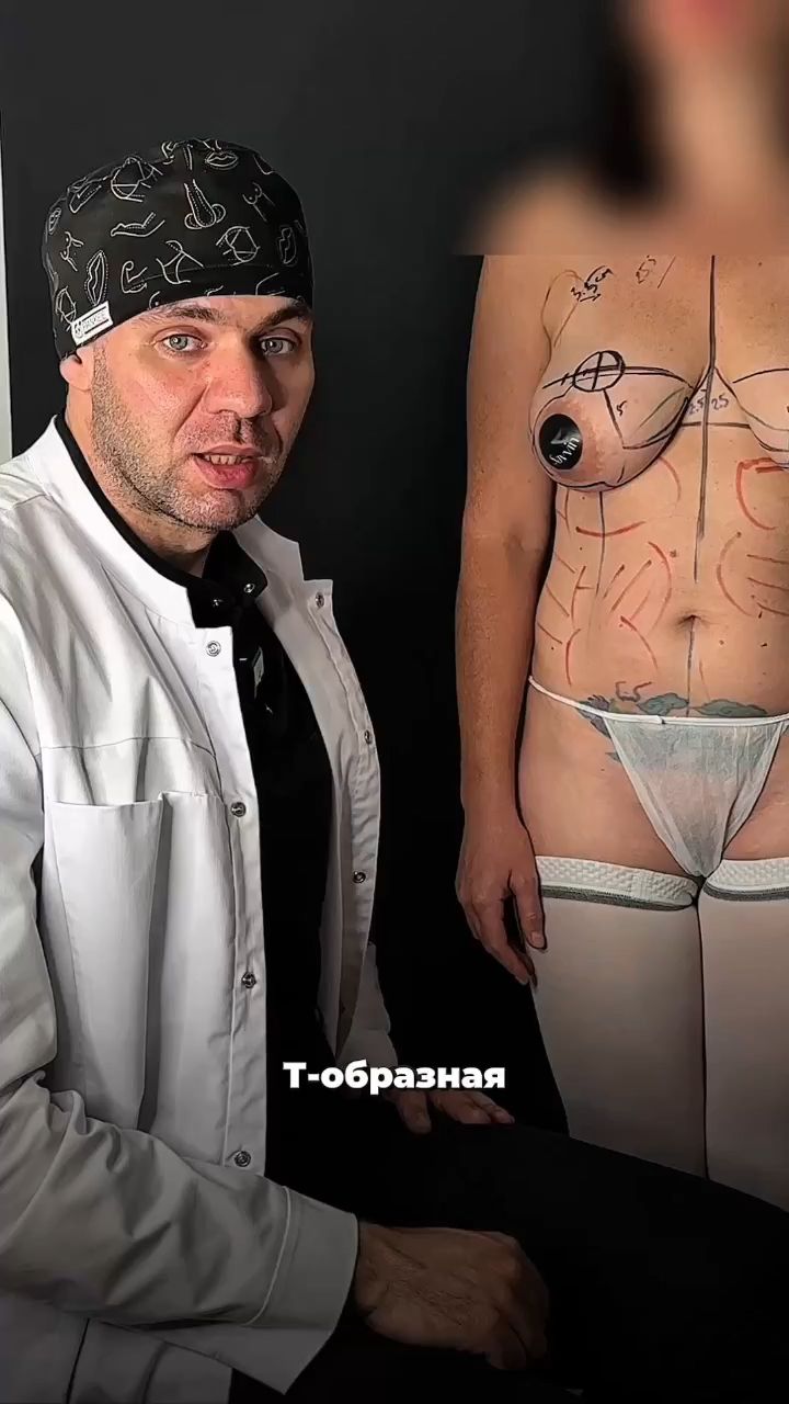 Почему Т-образная подтяжка — это надёжно, а не просто «шов»
