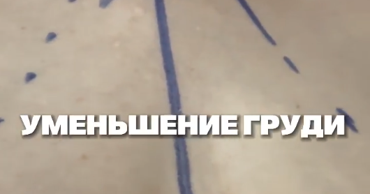 Устали носить тяжёлую грудь?