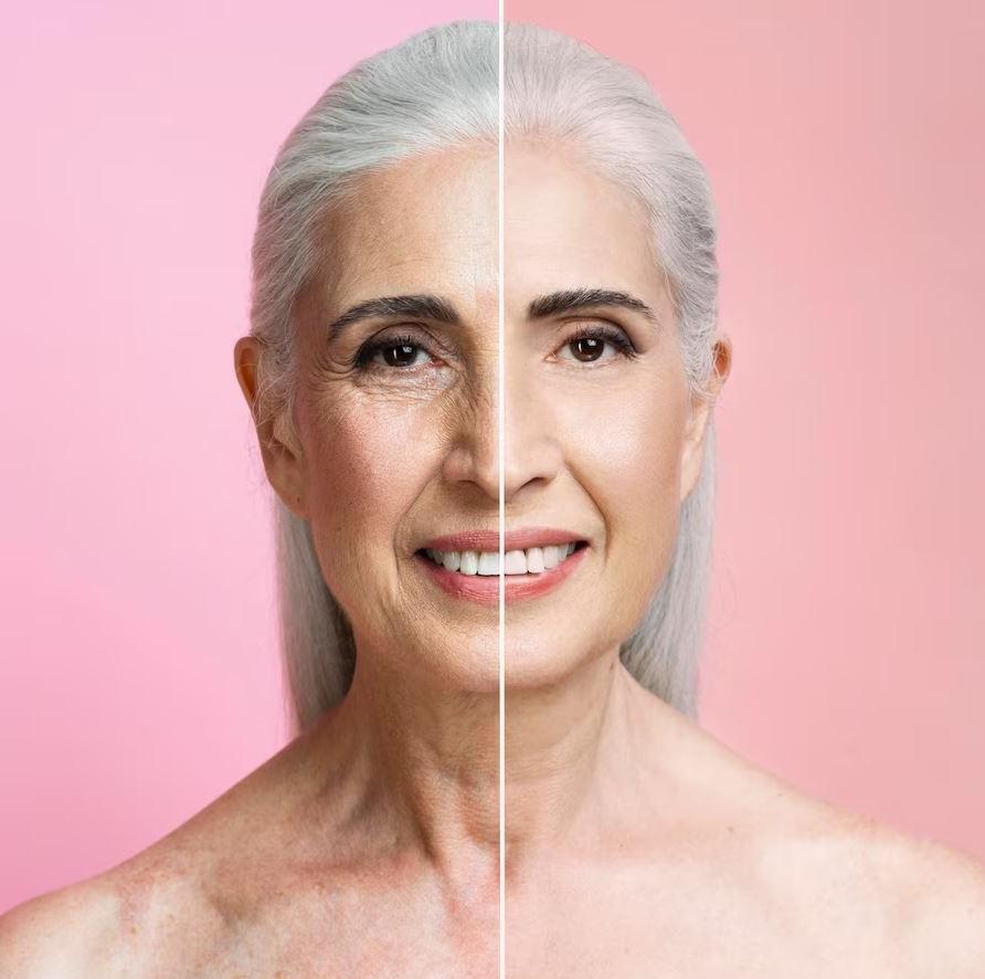 Коллагеновое омоложение Collost Micro