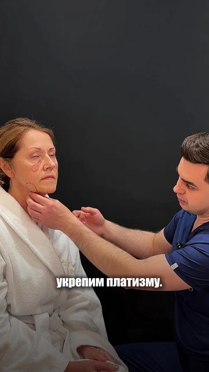 Smas лифтинг и платизмопластик