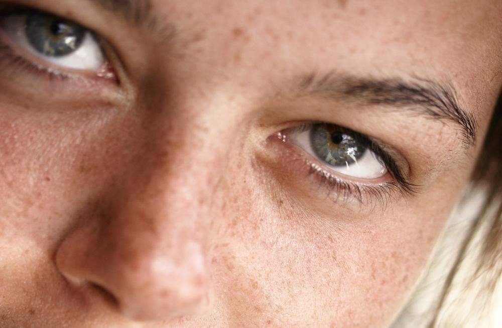 Омоложение диодным лазером 