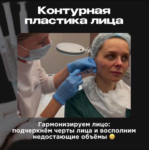 Что делать с этим валиком?