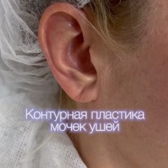 Уши тоже выдают возраст