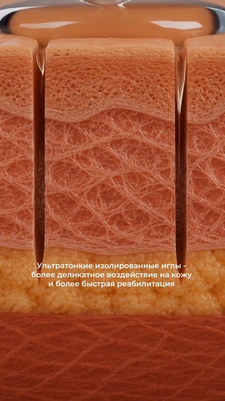 Genius RF: стимуляция коллагена и деликатное омоложение кожи