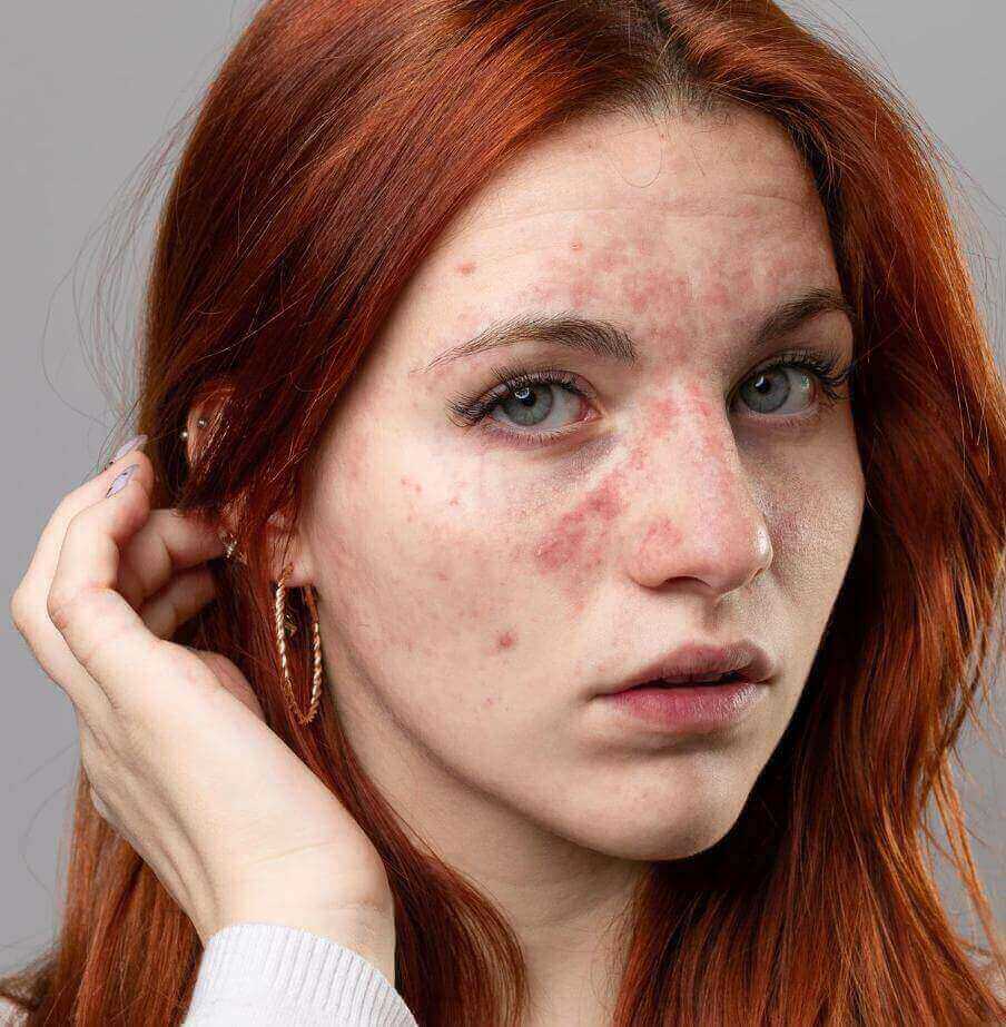 противопоказания