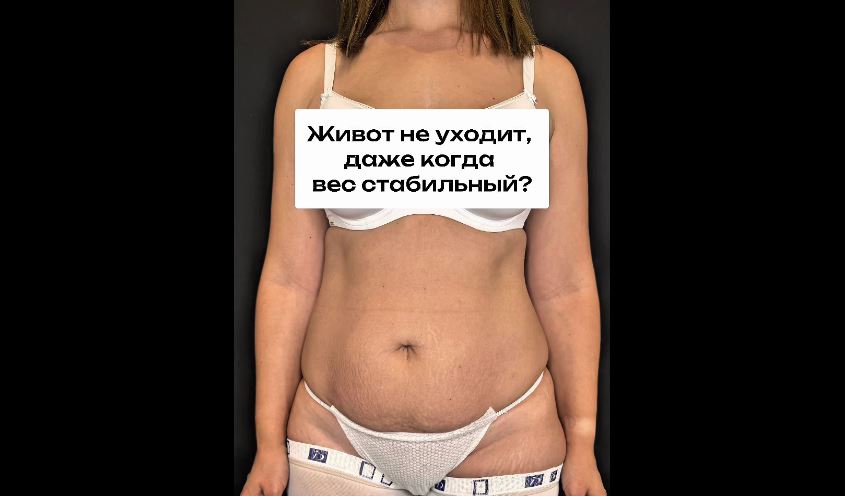 Живот не уходит, даже когда вес стабильный?
