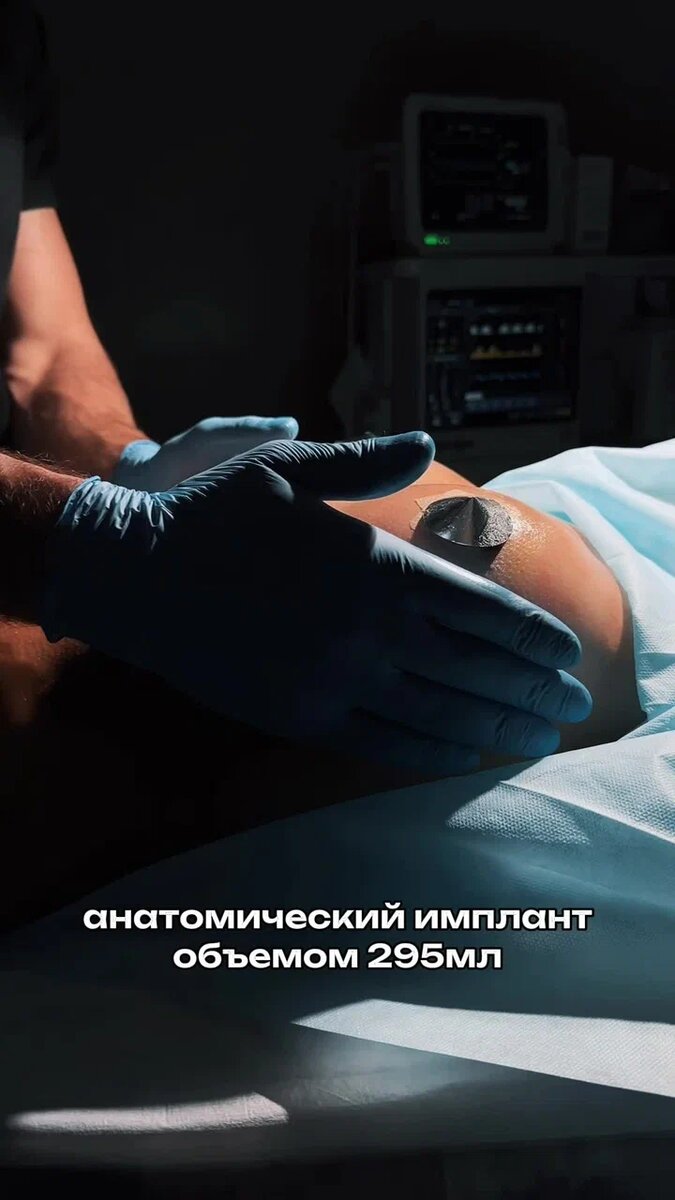 Стоит ли паниковать, если требуется замена имплантов?