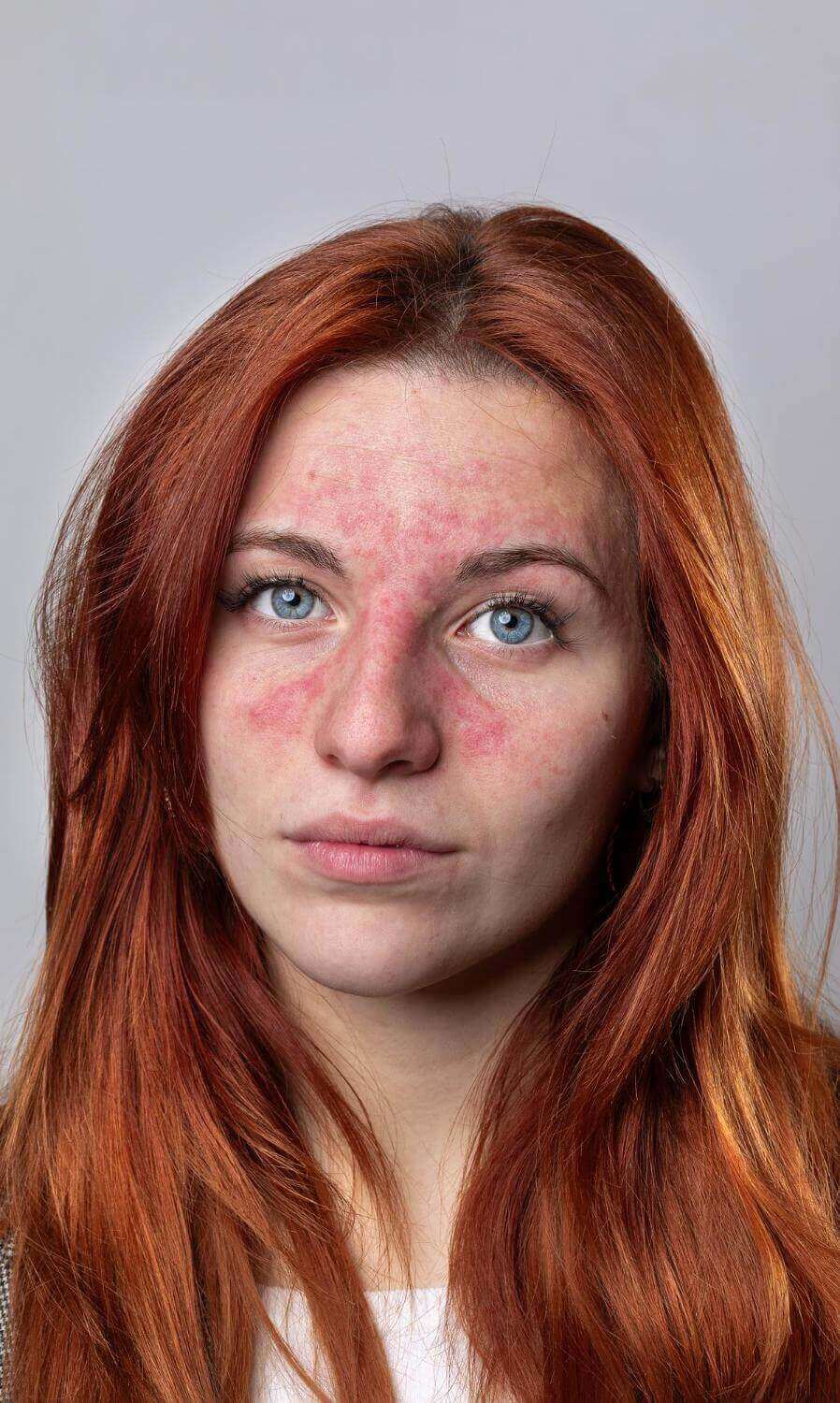 противопоказания