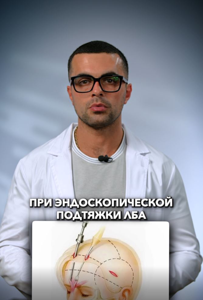 Выбривают ли волосы при эндоскопической подтяжке