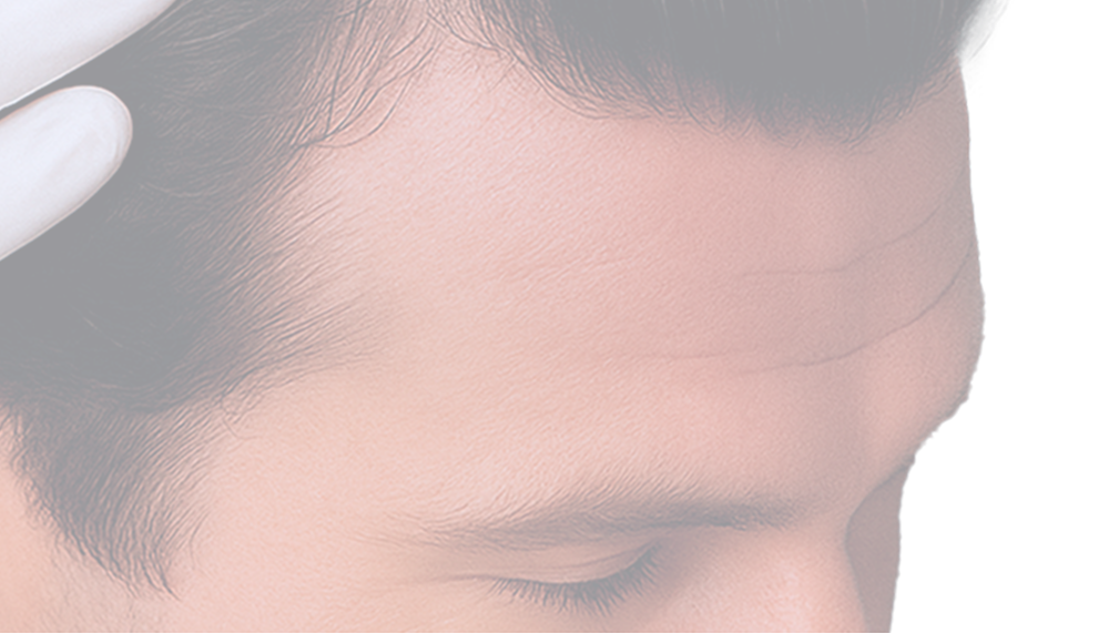 лазерная стимуляция роста волос