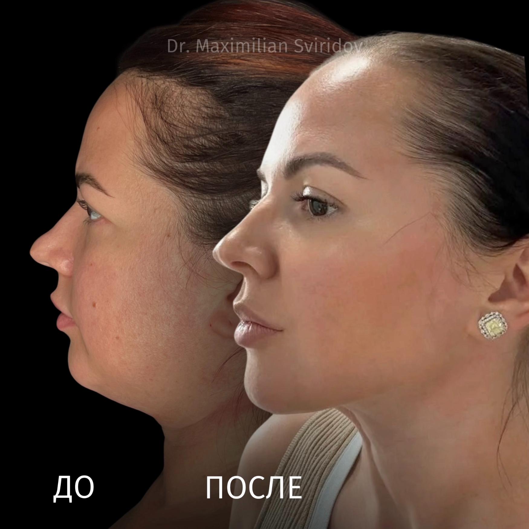 Результат, которым хочется поделиться
