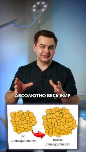 З - Липофилинг
