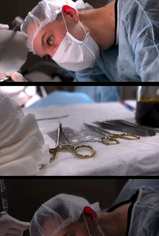 Я могу говорить много про то, какая классная технология «Грудь без шва»