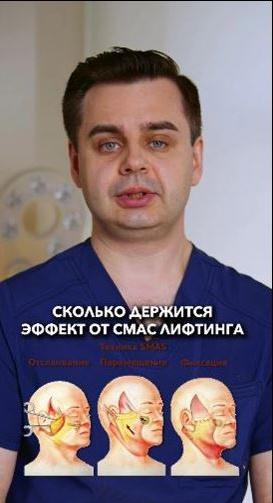 Сколько держится эффект от СМАС лифтинга