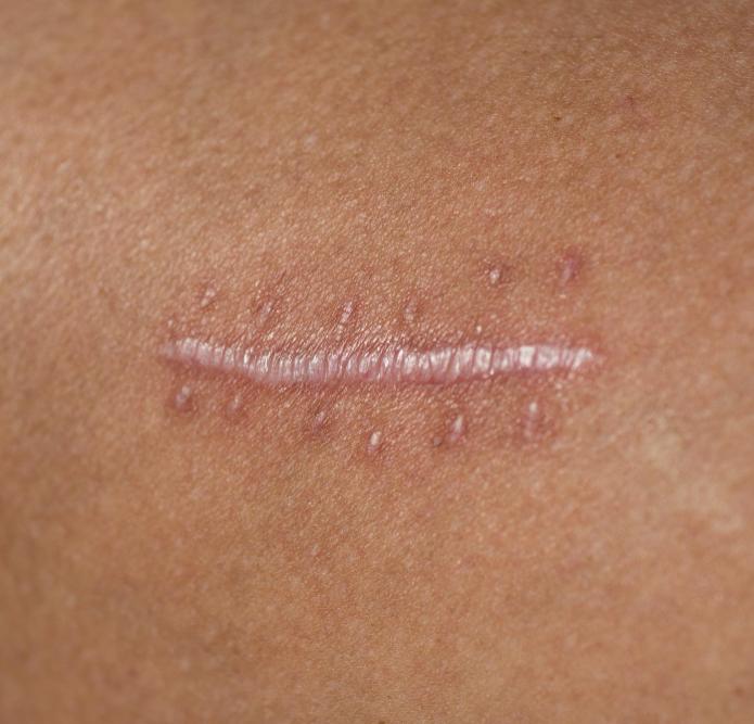 противопоказания