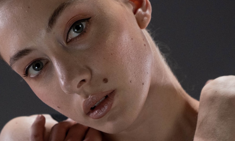 Родинка или бородавка: что такое кератома и как от нее избавиться