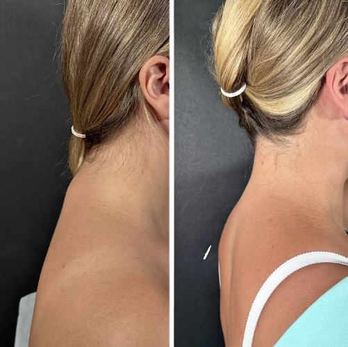 Холка — это зона, с которой можно и нужно работать.