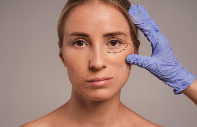 Поднятие наружных уголков глаз (кантопексия)