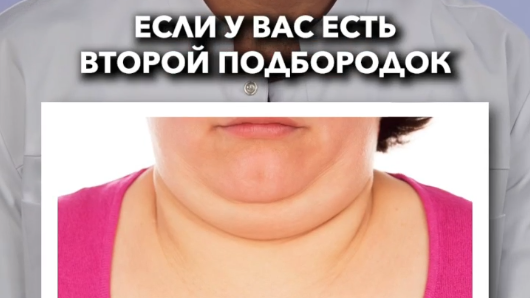 Второй подбородок