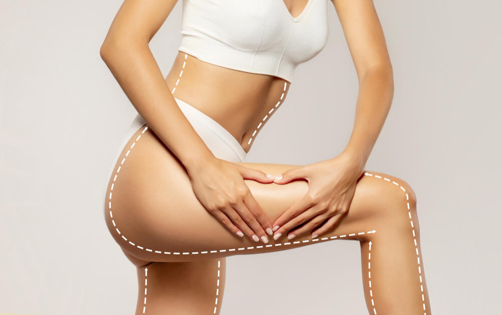 Липосакция бедер