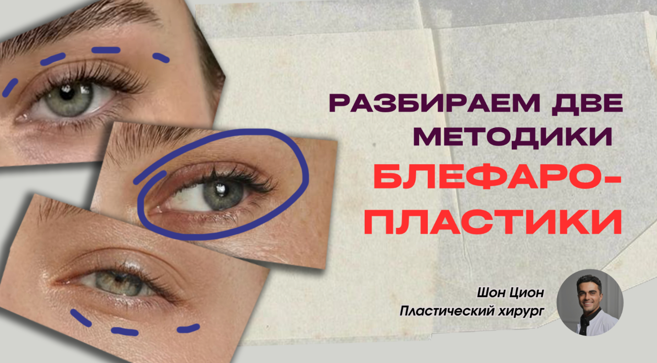 Хирургия Взгляда: Как Вернуть Лицу Отдохнувший Вид