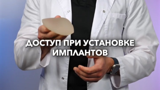 Доступы установки имплантатов