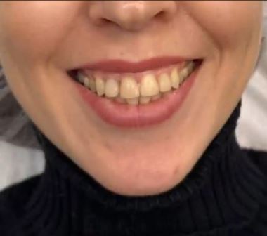 Идеальная улыбка – это просто!