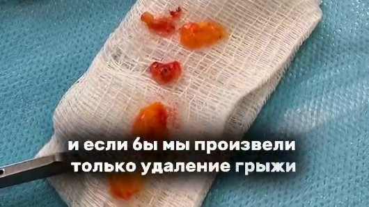 Что избавит от грыж в области нижнего века? Классическая или трансконъюктивальная  блефаропластика?